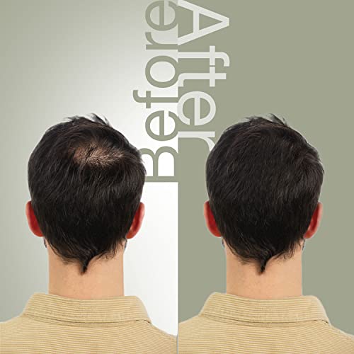 Комплект за Възстановяване на косата Mossi London , Определени за Растеж на косата с шампоан за изтъняване на косата