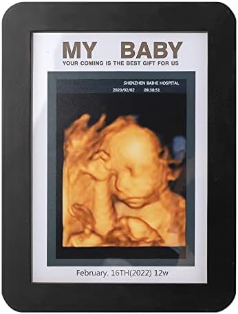 Рамка за снимка с Сонограммой Дете, Ултразвукова Фоторамка Реклама за бременност, Рамка за Снимка с Сонограммой,
