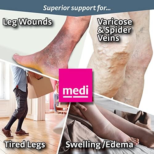 mediven Comfort за мъже и жени, 30-40 мм hg. супена, Чорапи с висока компресия на долната част на краката, Открит чорап