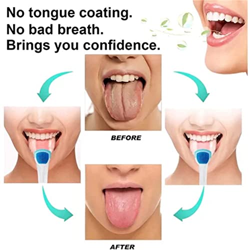 Четка за хигиена на устната кухина и Почистващ Гел за език, Набор на Пробиотични Гелове За почистване на езика, Гел За почистване